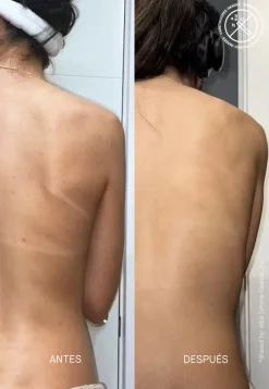 Acnemy Pflege·Body Mist|