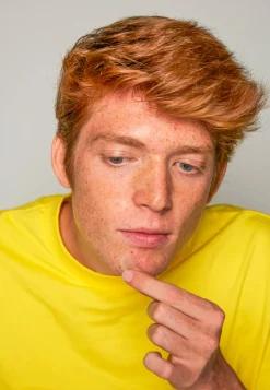 Acnemy Spezialpflege·Akne|