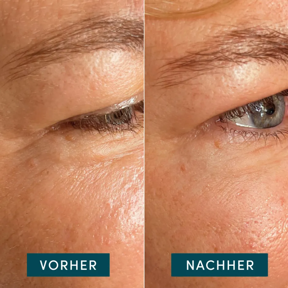 Apricot Augenpflege·Augenpflege|