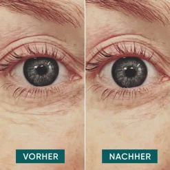 Apricot Augenpflege·Augenpflege|