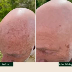 BETTER BE BOLD ·Kur & Serum|