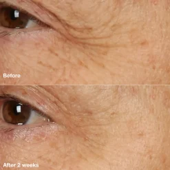 Clinique Gesichtpflege·Nachtpflege|