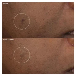 Clinique Gesichtpflege·Gesichtspflege|