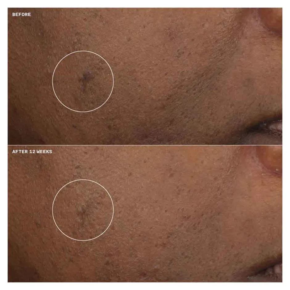 Clinique Gesichtpflege·Gesichtspflege|