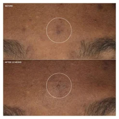 Clinique Gesichtpflege·Gesichtspflege|