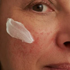 DADO SENS Spezialpflege·Gegen Couperose|