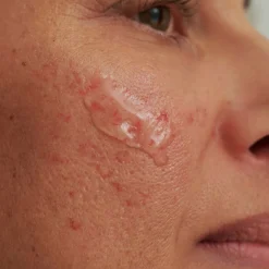 DADO SENS Serum & Kur ·Serum|